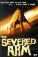 THE SEVERED ARM