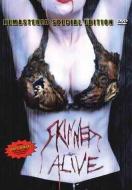 SKINNED ALIVE